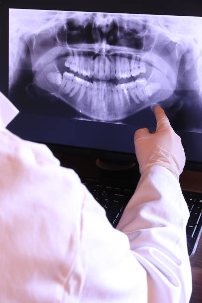 Best Emergency Tooth Extraction in San Lorenzo, CA