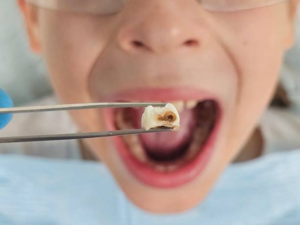Best Weekend Emergency Dentist in San Lorenzo, CA